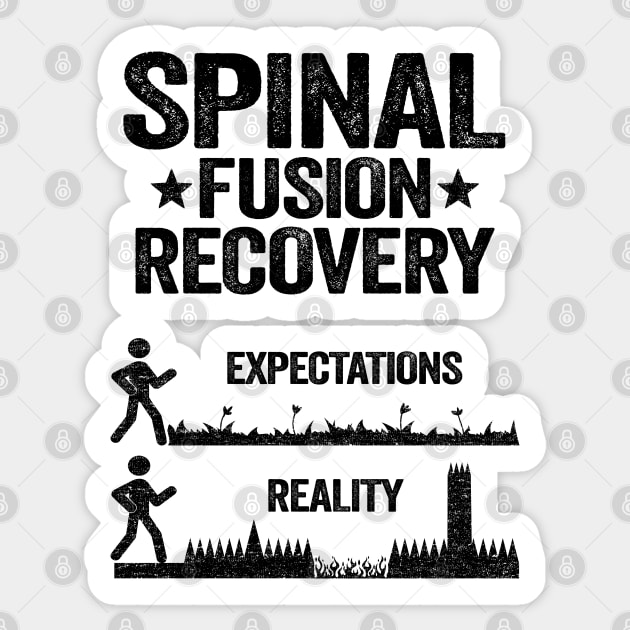 Bionic Spine Surgery Lumber Spinal Fusion Back Recovery Sticker by Kuehni